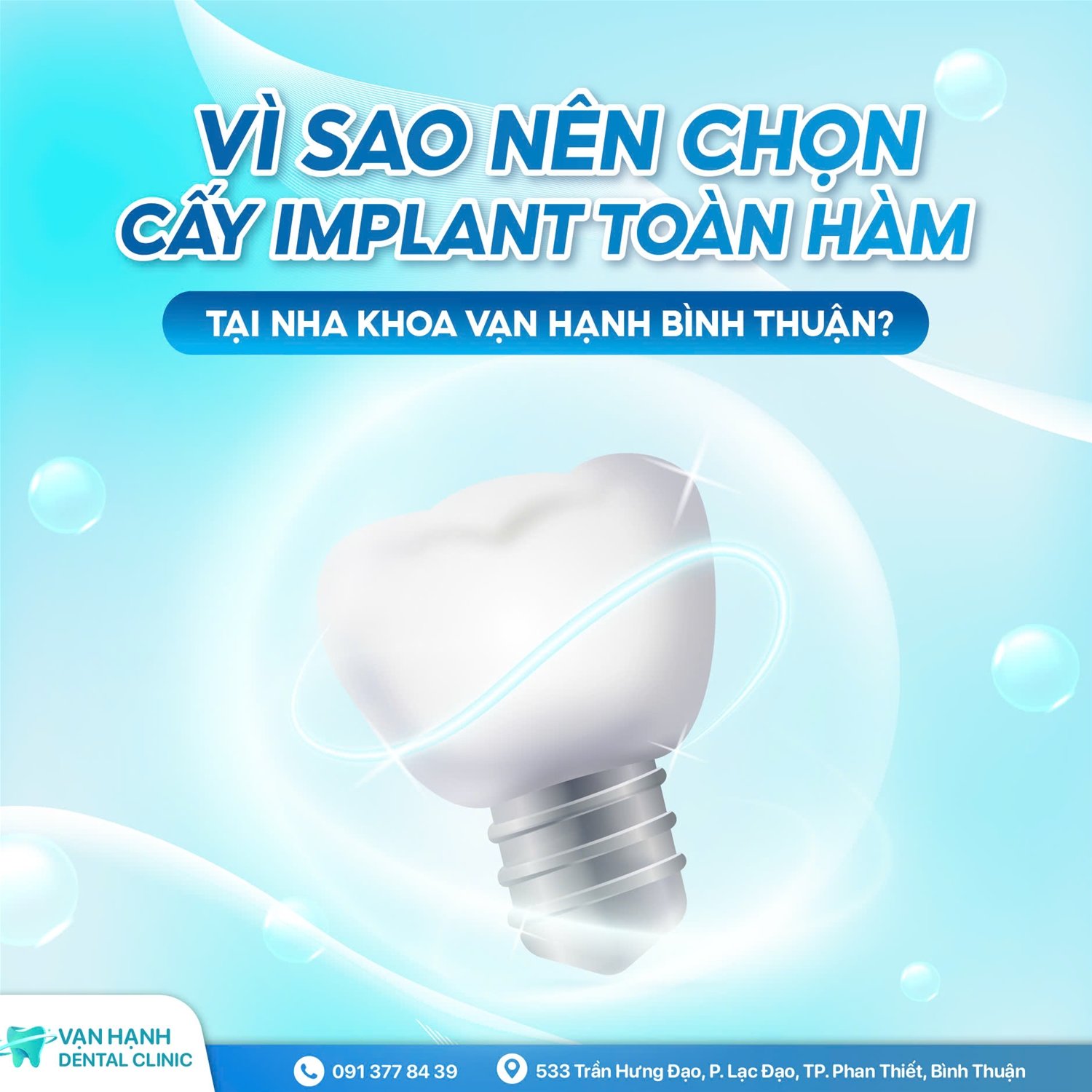 VÌ SAO NÊN CHỌN CẤY IMPLANT TOÀN HÀM TẠI NHA KHOA VẠN HẠNH BÌNH THUẬN