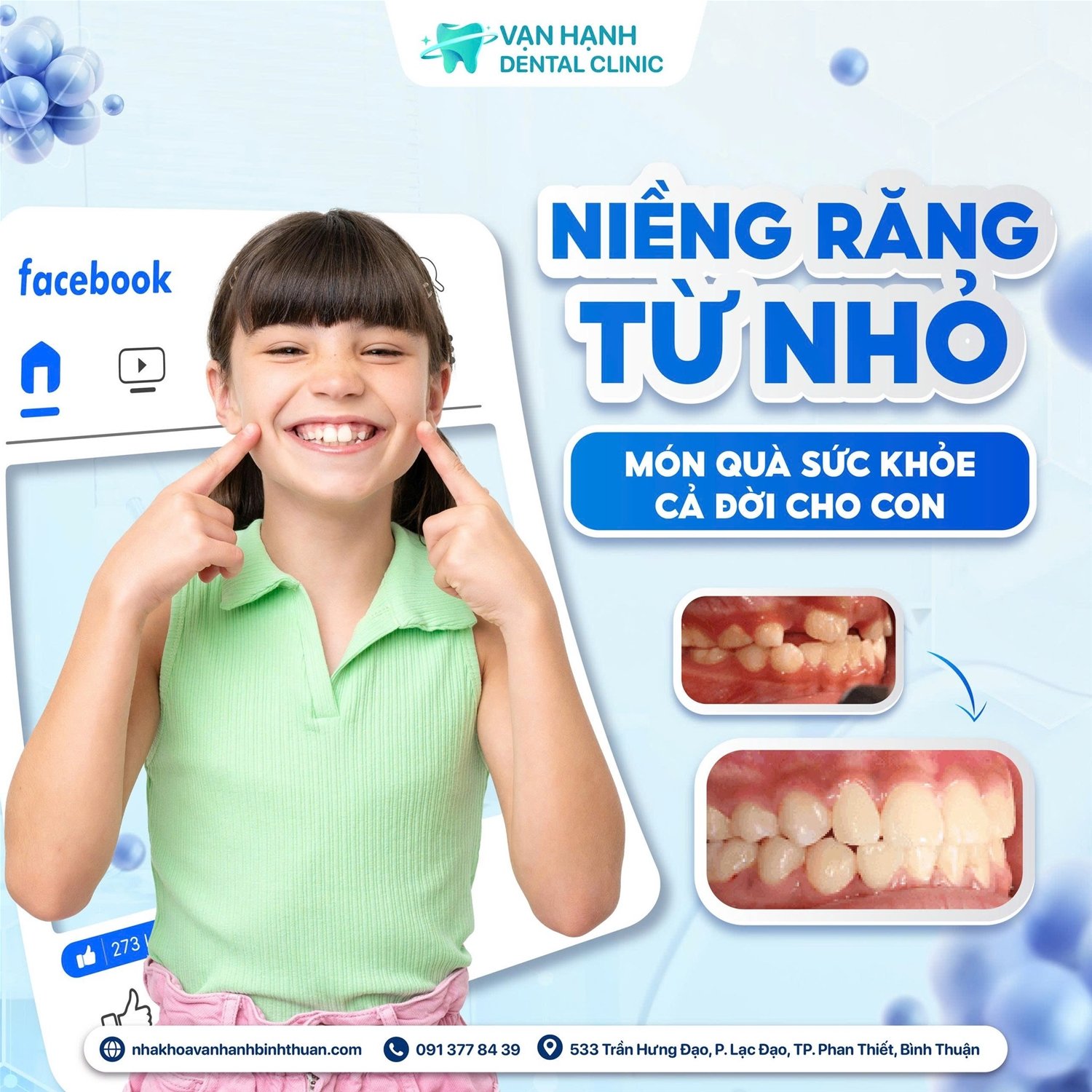 NIỀNG RĂNG TỪ NHỎ - CHÌA KHÓA VÀNG CHO NỤ CƯỜI HOÀN HẢO CỦA CON!