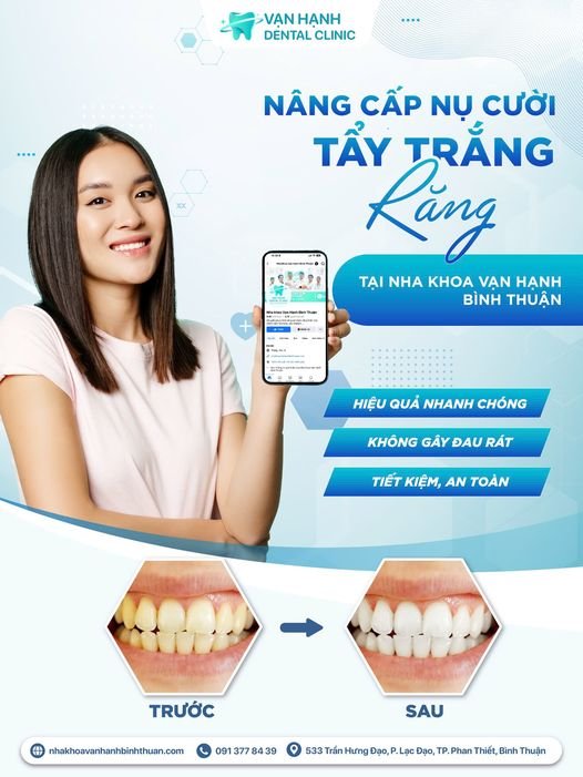 NÂNG CẤP NỤ CƯỜI: TẨY TRẮNG TẠI NHA KHOA VẠN HẠNH BÌNH THUẬN