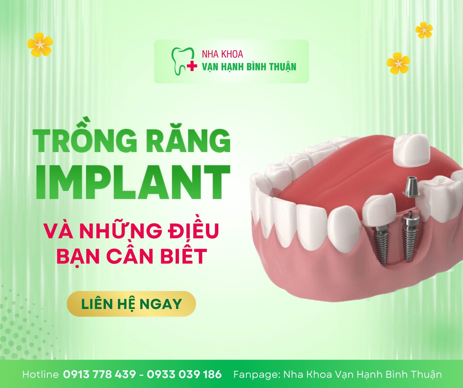 TRỒNG RĂNG IMPLANT-NÂNG TẦM CHẤT LƯỢNG CUỘC SỐNG
