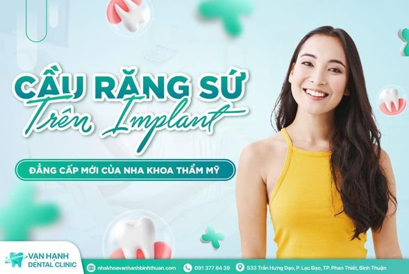 RĂNG SỨ TRÊN IMPLANT