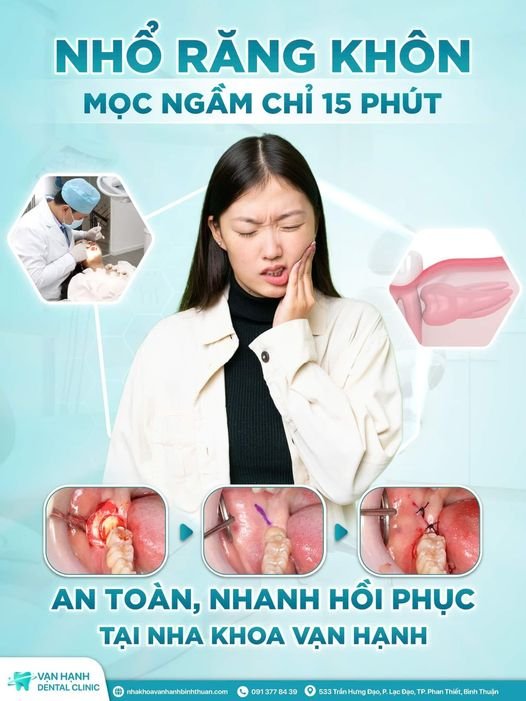 NHỔ RĂNG KHÔN MỌC NGẦM