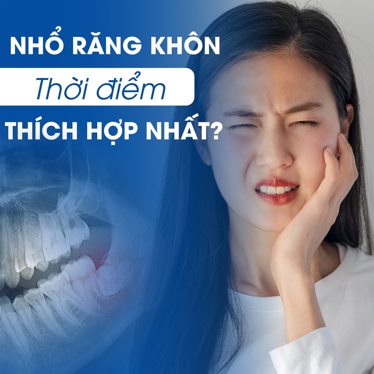 Răng khôn có tác dụng gì? Khi nào nên nhổ?