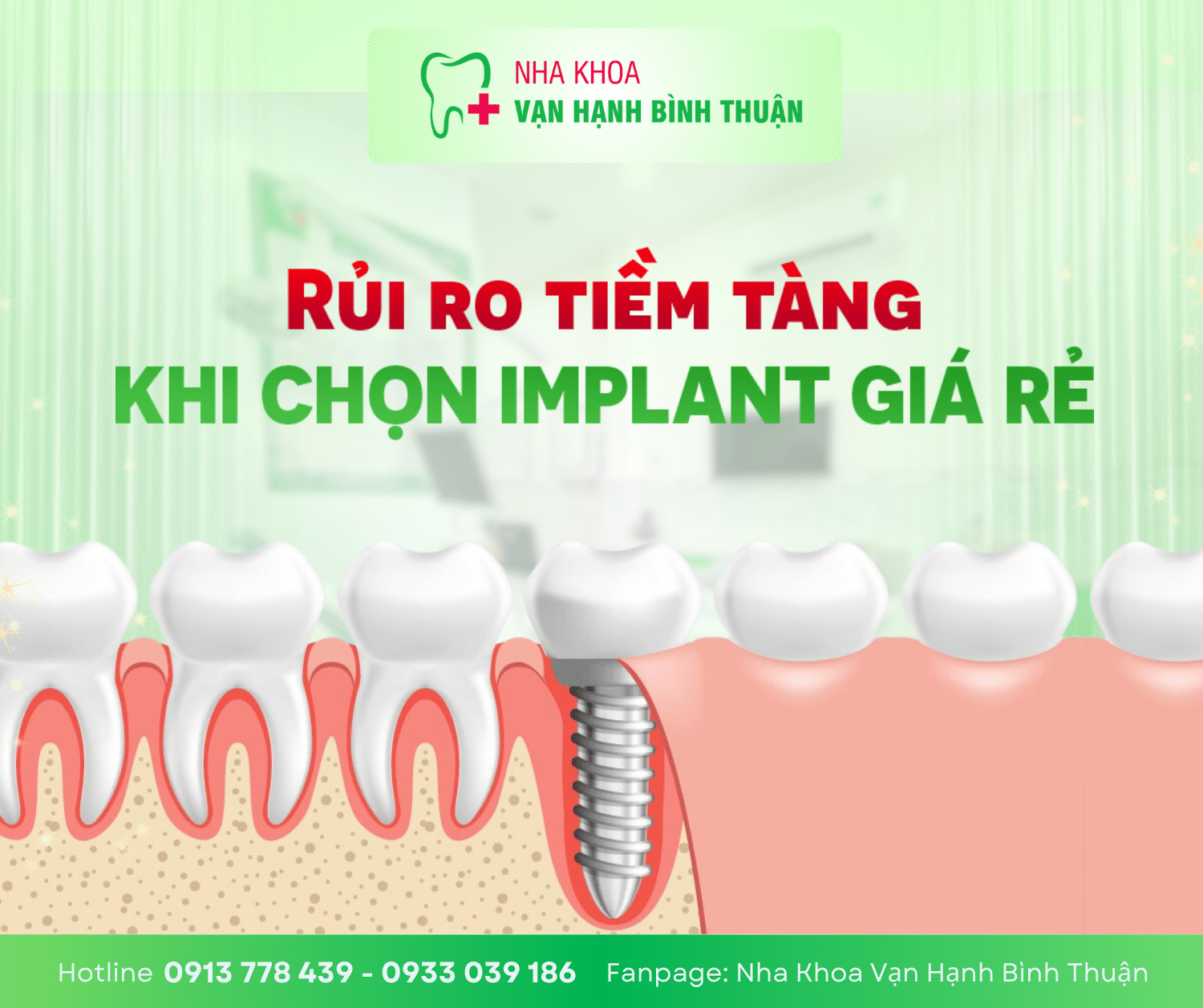 Lựa Chọn Implant Răng Giá Rẻ: Tiết Kiệm Hay Rủi Ro?