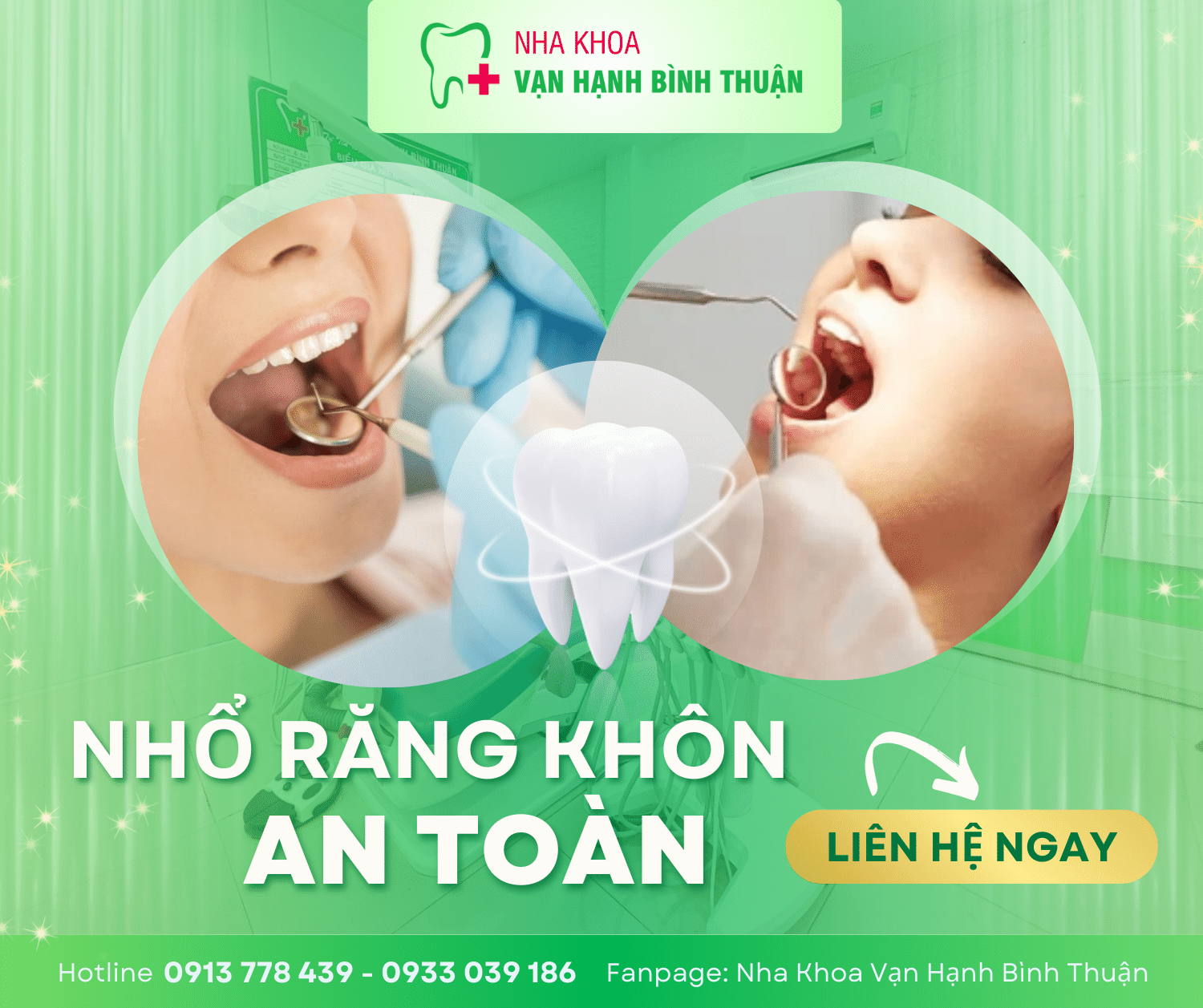 Dịch vụ Nhổ răng khôn tại nha khoa Vạn Hạnh Bình Thuận