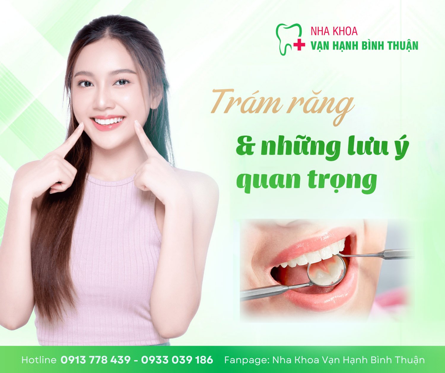 Trám răng và những lưu ý quan trọng