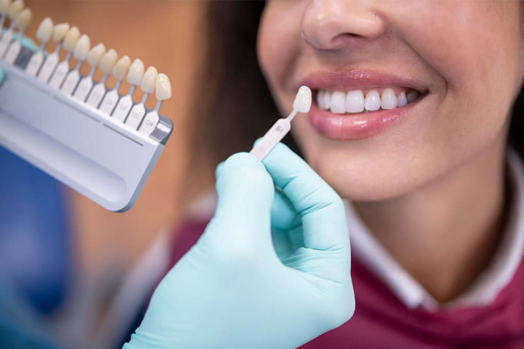 Răng sứ - Răng giả